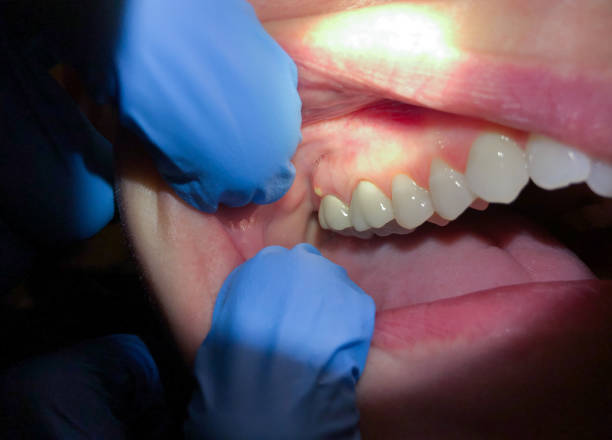 Best Urgent Dental Care  in Secy, AR
